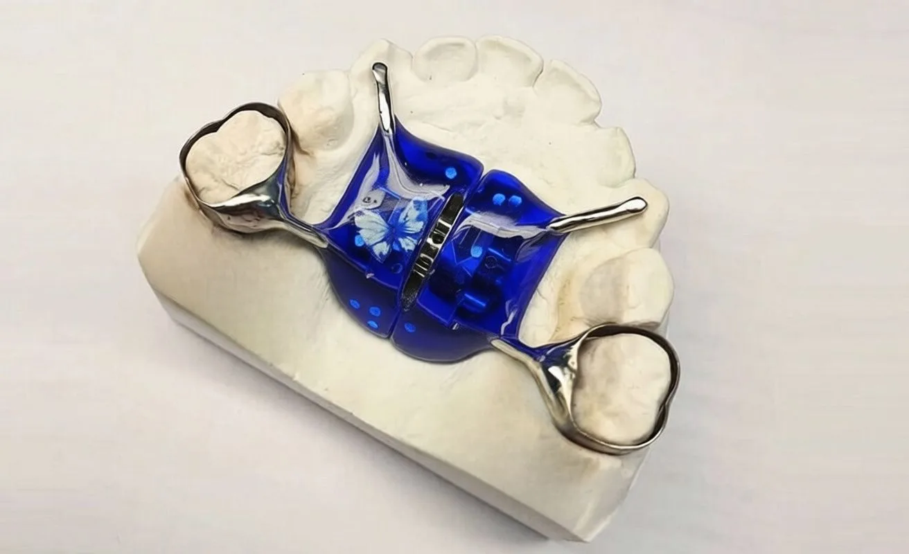 несъемные аппараты