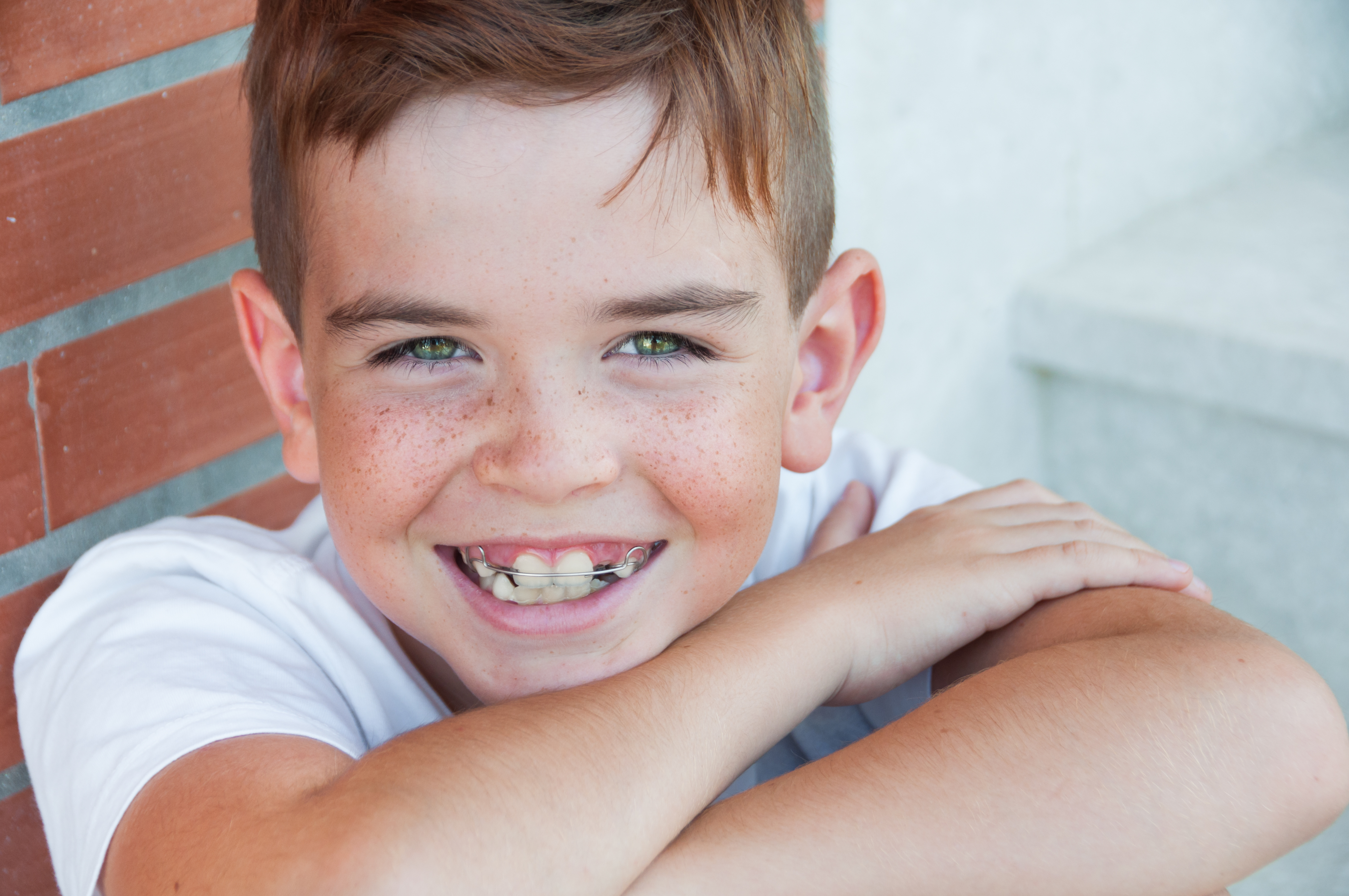 несъемные аппараты